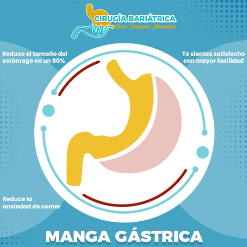 Manga gástrica