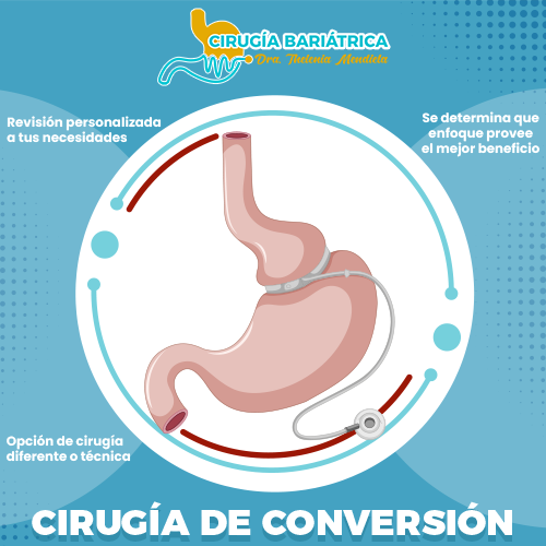 Cirugía de Revisión
